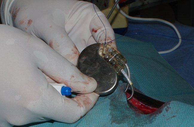 Vložení kardiostimulátoru psu při operaci vedené MVDR. Scheerem